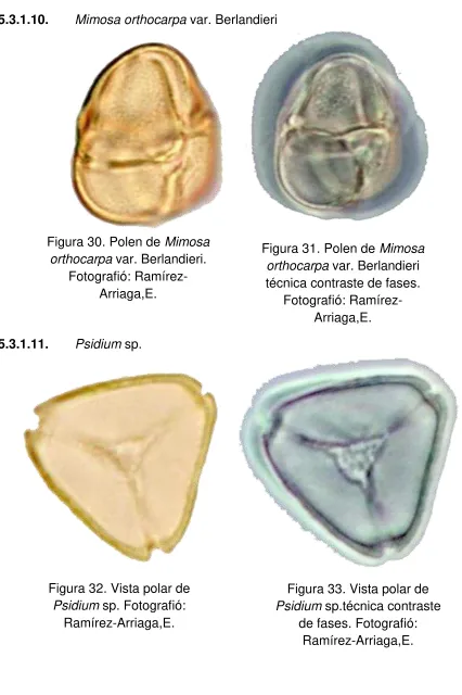 Figura 30. Polen de Mimosa 