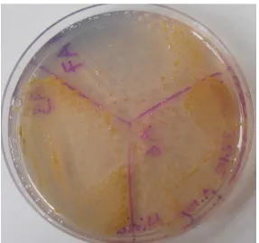 Figura 1.7. Crecimiento bacteriano en el medio de cultivo PA20, donde se observa la presencia de inclusiones de  color oscuro en el centro de las colonias