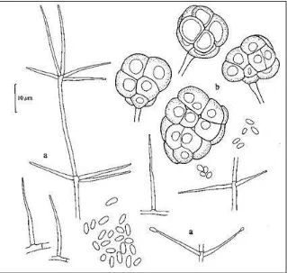 Figura 3.     Pochonia chlamydosporiay simples b)=Dictioclamidosporas  (Gams, 1988).  var