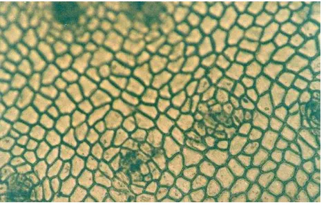 Figura 1.- Figura 1.- Patrón epidérmico de  Agave kerchove (estructura celular y 