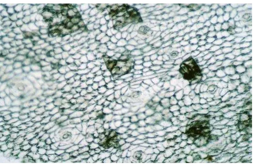 Figura 4.-  Patrón epidérmico de Jatropha neopaciflora (estomas abiertos y arreglo 