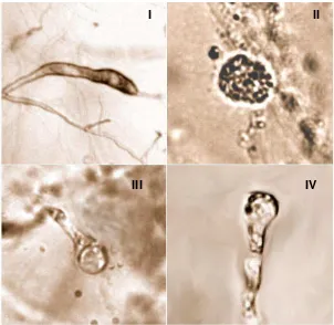 Figura 9. Estructuras observadas de los aislamientos 2c, 3c, 5c, 6c, 7c, 9c y 10c., obtenidos con medio selectivo a Pythium spp