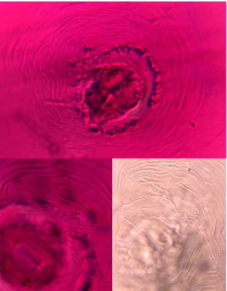 Figura 1.6. Microfotografía de patrones perineales de Meloidogyne hapla.  