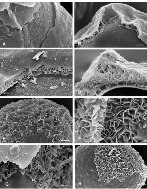 Figure 8. Structure of the perispores in BlechnumD.(B, D, E), 5  species. A. Blechnum auriculatum