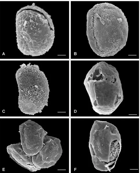 Figure 3. Perispores in Blechnumbars – 5  species. A–C. Perispore with thin, discontinuous superficial stratum: A