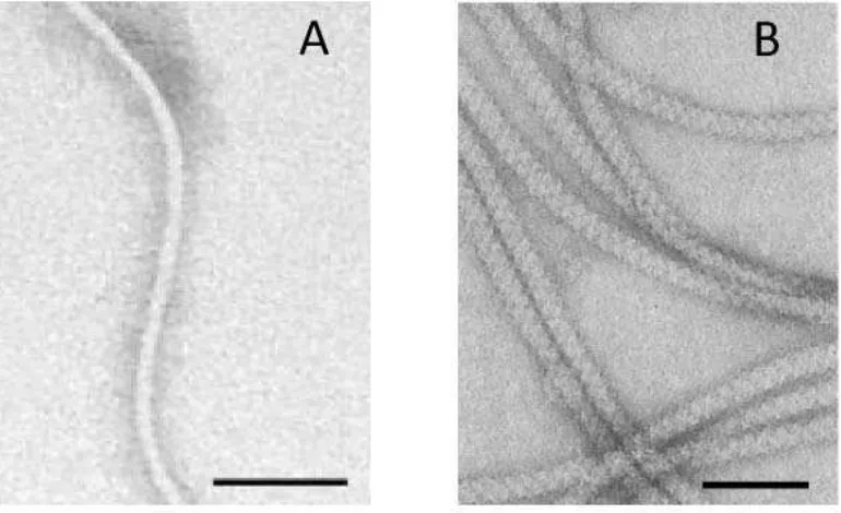 Figura I.12 Microscopía electrónica de transmisión.(Krupski  A) Flagelo simple (Kanbe et al., 2007)