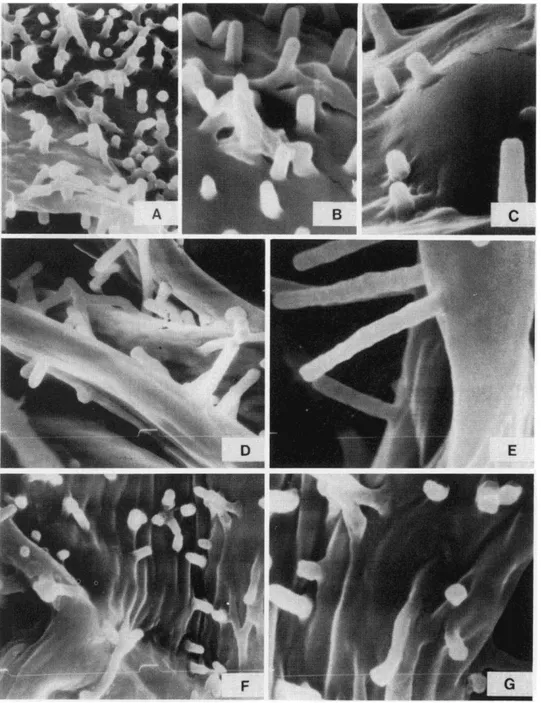 Fig. 5. Microprojections of mesophyll cell walls in Christe11Se11ia aesculifolia subsp