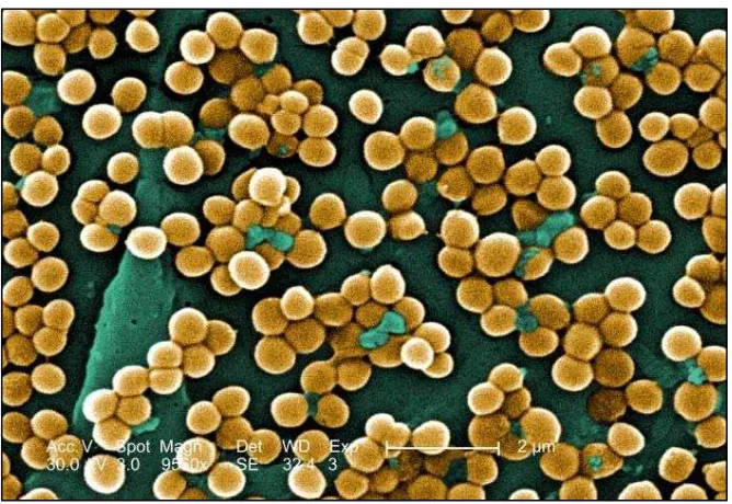 Figura 11. Staphylococcus aureus.
