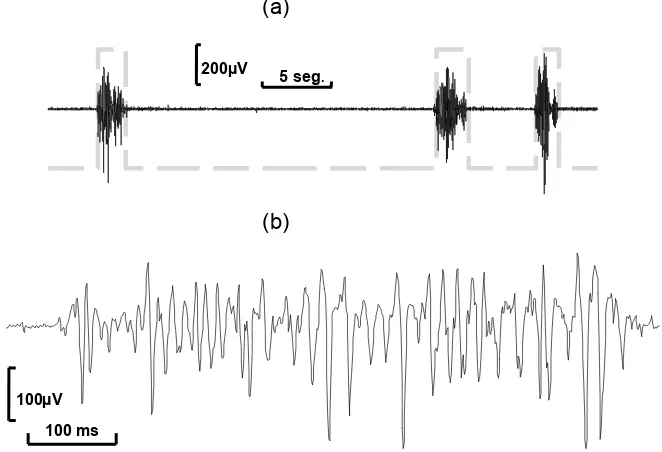 Figura 3: a) señal de EMG del músculo bíceps-brachii sin procesar (en negro) y señal binaria que 