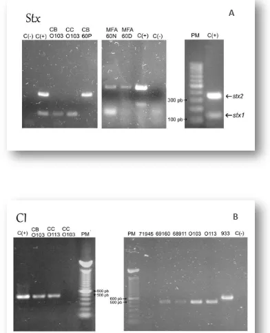Figura 2.2  Fotografías de las bandas obtenidas por amplificación por PCR de los genes: stx1 y stx2 (A) y cI (B) y electroforesis en geles de agarosa