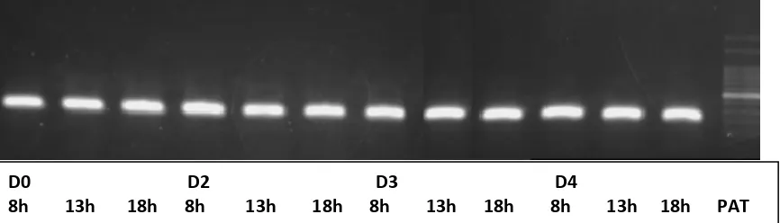 Figura  3.  Electroforesis  de  los  fragmentos  de  ADNc  amplificados  por  PCR  para  las  muestras