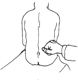 Figura 2