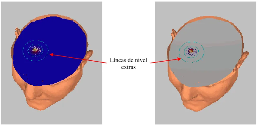 Figura 5: (a)Visualización como zonas de nivel. (b) Modificación del rango visualizado 
