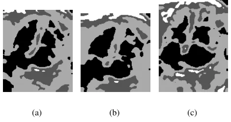 Figura 8: Imagens segmentadas utilizando a m´edia e pr´e-processamento com ﬁltro da mediana