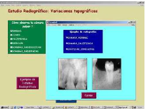 Figura 2 – Variaciones topográficas.