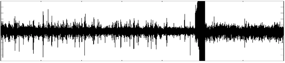 Figure 1: Example of an EEG signal exhibiting a burst at seizure onset. 