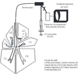 Fig 4. Esquema del sistema de lavado bronqueo alveolar empleado