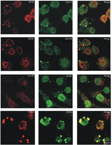 Figure 1: Colocalization of eIF4E with components of PBs and SGs shows a diversity of cytoplasmic foci quality