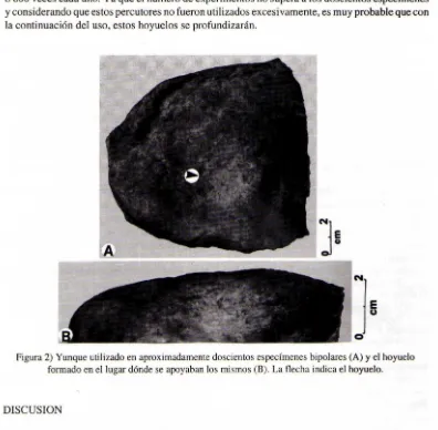 Figura 2) Yunque utilizado en aproximadamente doscientos especímenes bipolares (A) y el hoyuelo 