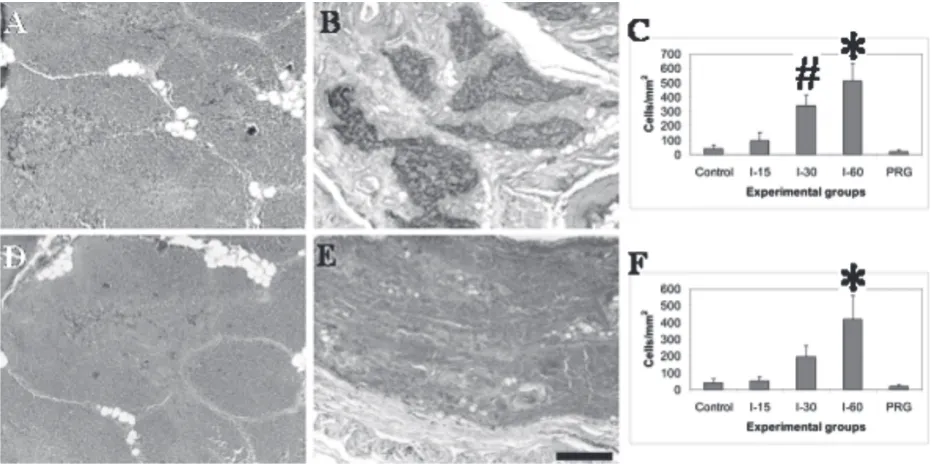 Fig.5. Immunohistochemical pattern of Sg-poisoned thymus. Control (A,D) and I-60 (B,E) groups