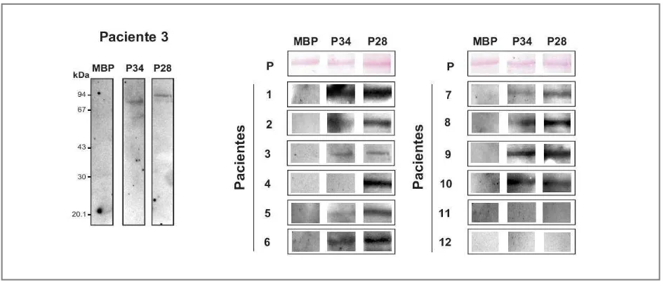 Figura 3. Inmunoblots con sueros de pacientes alérgicos a LV. Proteínas recombinantes MBP-P34 (P34), MBP-P28 (P28) y MBP (como control negativo) (2-3contra sueros de pacientes alérgicos a PLV
