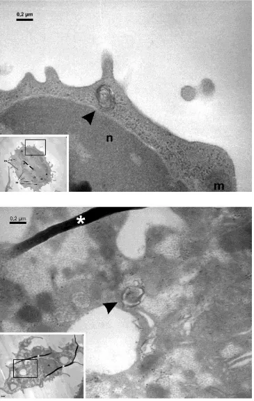 Figura 9: Inclusiones lamelares (flechas) observadas mediante microscopía electrónica de transmisión en un linfocito (panel superior) y un monocito/macrófago (panel inferior) provenientes de un paciente con EF