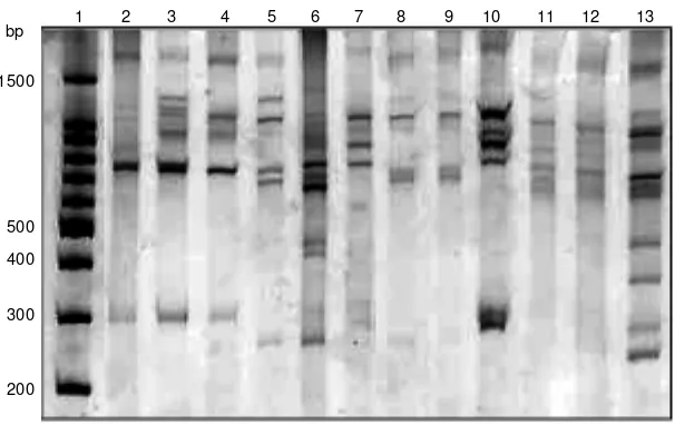 Figure 1. PCR-LIS-SSCP analysis of HLA-DQA1 group alleles. : Molecular weightDQA1* 0102+0103; DQA1* 0501+0501; DQA1* 0301+0501; gel at 40101+ 0201; lane 3:olane 7lane 13lane 10lane 6: DQA1* 0102+ 0301; : DQA1* 0103+0501