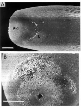 Fig. 9: scanning electron photographs of female posterior end of Beatogordius variabilis, paratype (MLP 3660)
