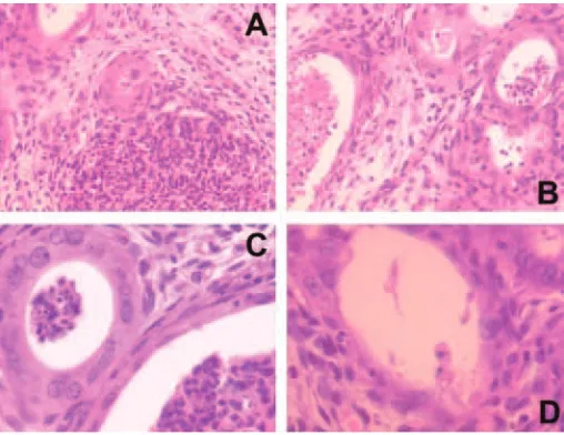 Figura 7.  Cortes histológicos de úteros de ratonas preñadas infectadas conTritrichomonas foetusendometriales