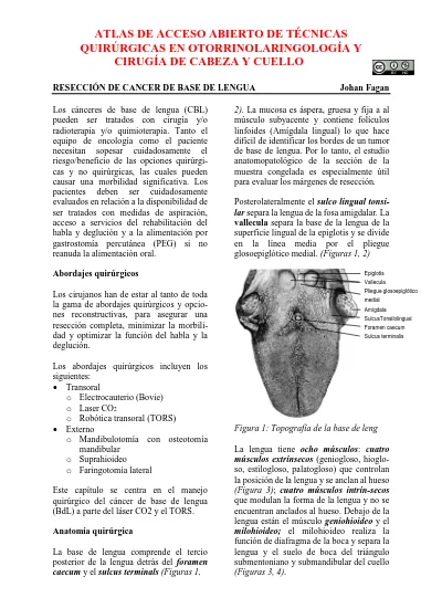 Atlas De Acceso Abierto De TÉcnicas QuirÚrgicas En OtorrinolaringologÍa Y CirugÍa De Cabeza Y Cuello