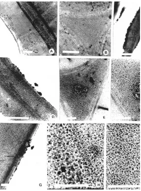 Figura 2. Fotomicrografías con MET: A-B, fibrotraqueidas, testigo sin impregnar: A, pared secundaria yelectrónicamente densos en ángulo entre células; G-I, fibrotraqueidas: G, depósitos en pared secundariadepósitos electrónicamente densos (flecha); D, pare