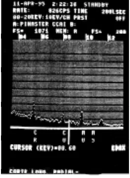 Figura 3. Análisis MEB-EDAX donde se observa elespectro de energía característico de los elemen-tos Cr, Cu y As.