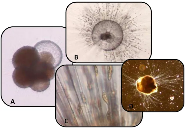 Fig.1.1 A) Foraminífero planctónico. B) Detalle de pseudópodos. C) Transporte de partículas
