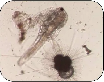 Fig.1.2. Copépodo capturado por un foraminífero planctónico (Foraminíferos de Japón- 