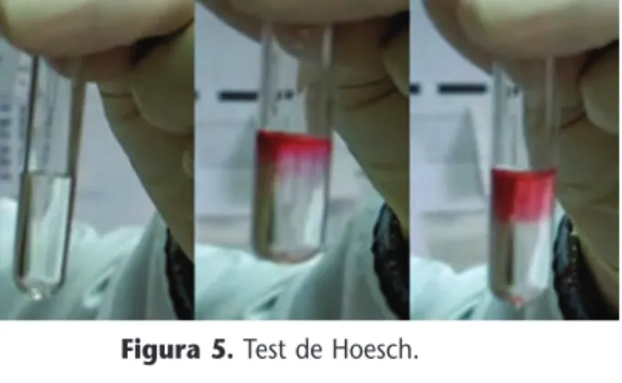 Figura 5. Test de Hoesch.