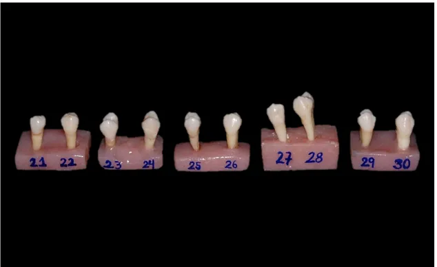Figura 4 Grupo 3: Premolares codificados del 21 al 30, previos a  preparación cavitaria