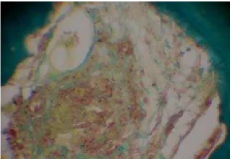 Figure 1.- Macroscopic aspect of the radio-ulnar-humerus joint of a mountain lion. There is severe damage in the articu-lar cartilage withcongestion,  erosion and exposure extensive of subcondral bone bilateral.