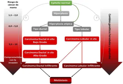 Figura 4. Modelo histopatológico de la progresión del cáncer de mama y riesgo de progresión a 