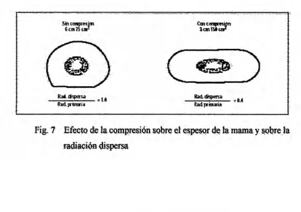 Fig. 7 Efectu d: In mmpresién sobre cl 030 espesnr de in mama. Y Sobre Ia radiacién dispersa