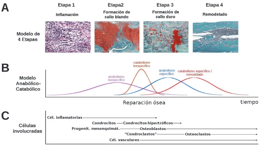 Figura I. 1. 6 – Reparación de fracturas. (A) Modelo de reparación en cuatro etapas. (B) Modelo anabólico / catabólico de reparación