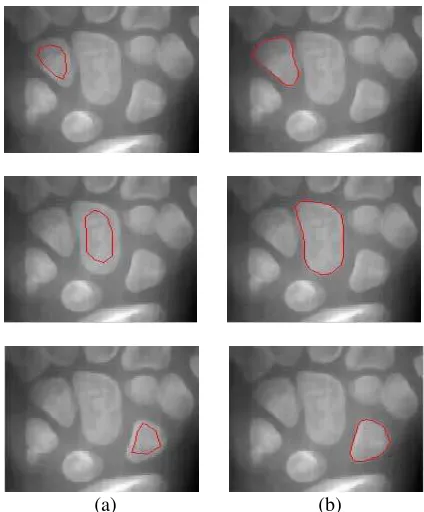 Fig.4 carpal bones image segmentation (a) initial snake (b) final result 