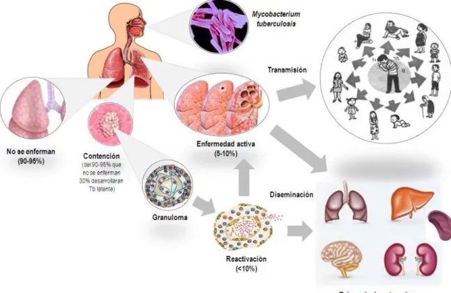 Figura 5. Vías de diseminación y patogenia de la infección por Mycobacterium tuberculosis