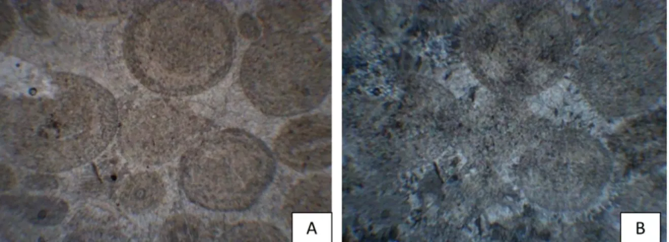 Figura 17. Imagen A. luz Natural y B. nicoles cruzados, Se observa oolitas normales y  superficiales en un cemento fibroso de aragonita