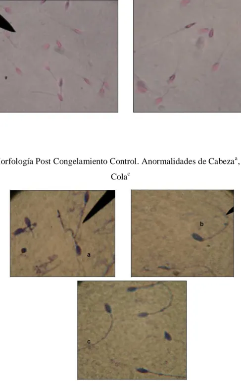 Foto 8. Morfología Post Congelamiento Control. Anormalidades de Cabeza a , Cuello b  y  Cola c