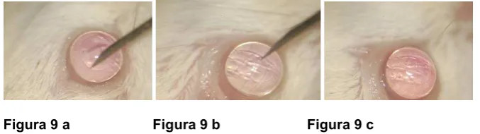 Figura 9 a                     Figura 9 b                      Figura 9 c      