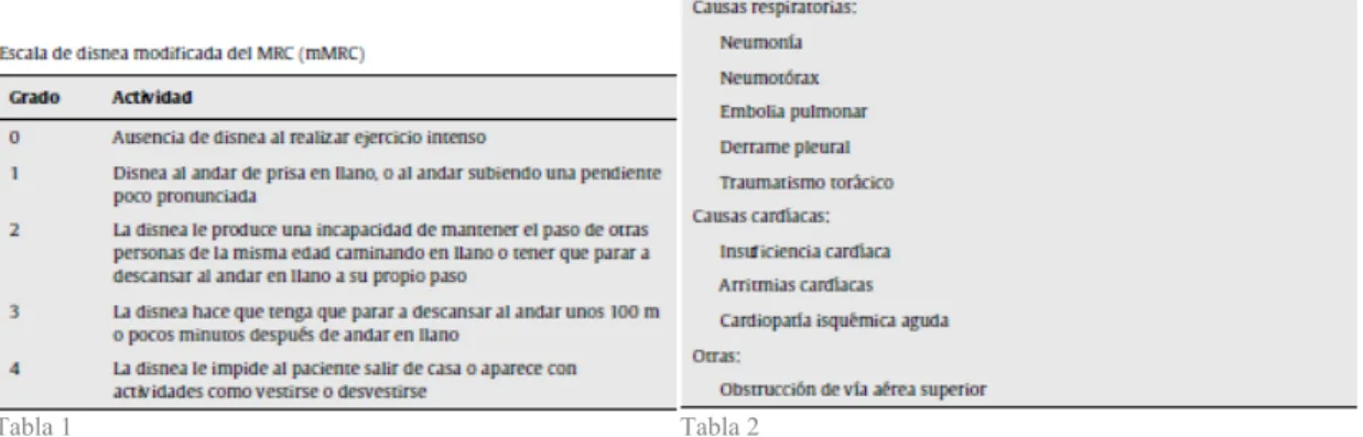 Tabla 1                                                                                            Tabla 2 