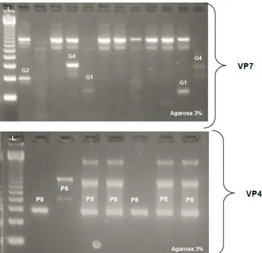 Figura 4. Productos de amplificación de los genes VP7 (G) y VP4 (P). L: 123 bp ladder.