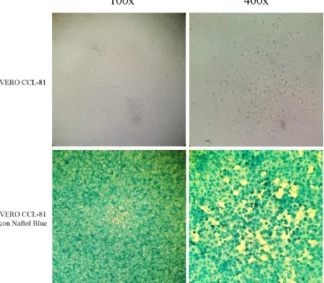 Fig. 6 Efecto citopático en células VERO CCL-81 infectadas con el virus  Chikungunya. 