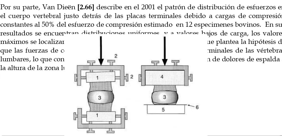Fig. 2.16 Alineamiento Sagital (Izquierda) Fractura Bursa de L2 tratada con una instrumentación segmental con tornillos pediculares