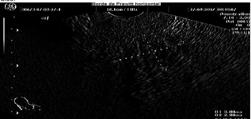 Fig 5.8  Operador de Prewitt horizontal.